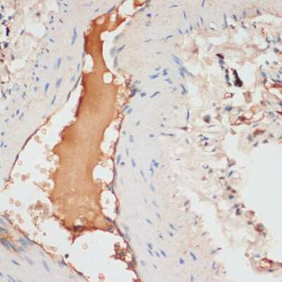 Immunohistochemistry-Paraffin: Apolipoprotein C1 Antibody - BSA Free [NBP2-91001]